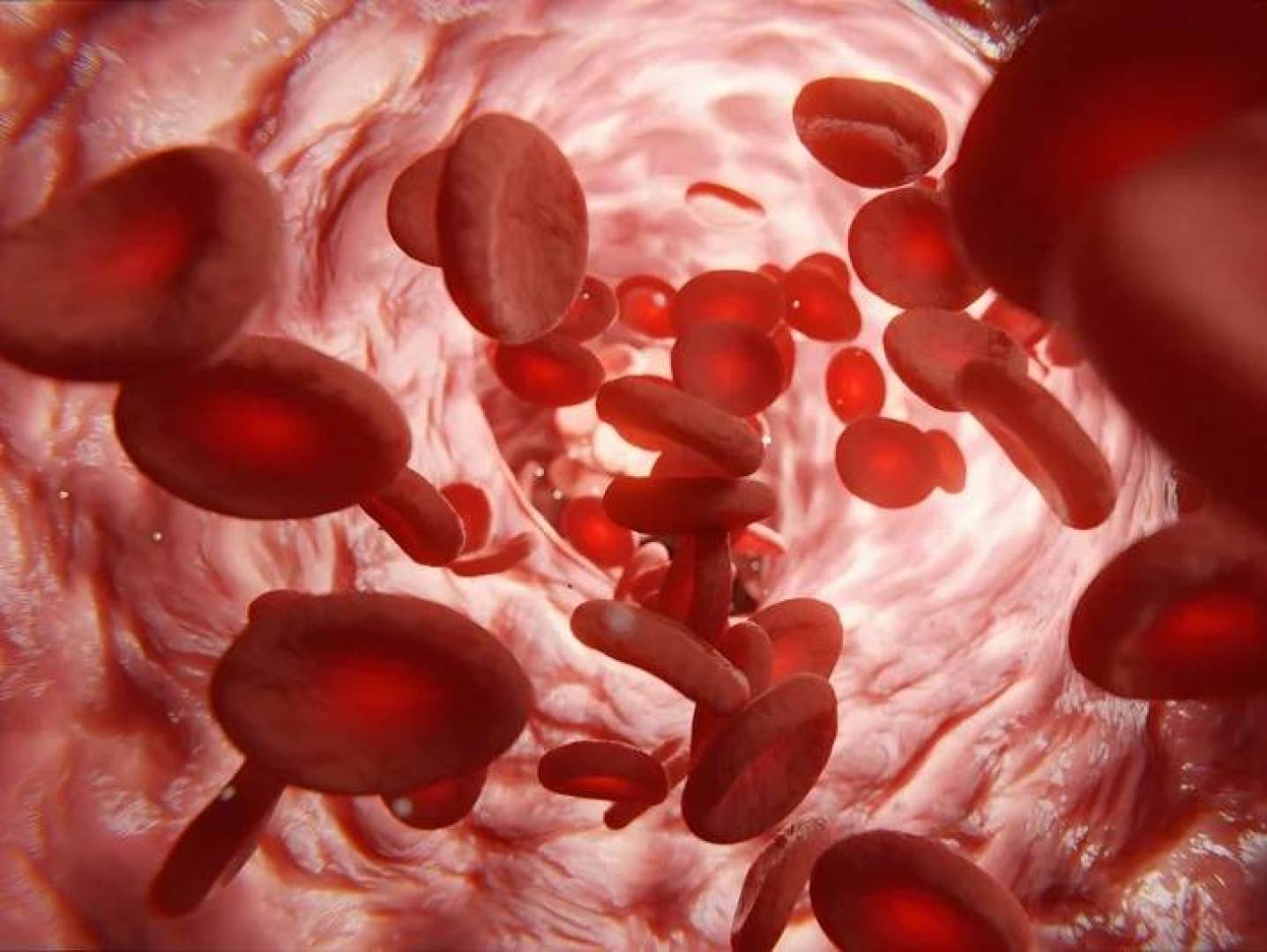 خطر اضطراب الهيموغلوبين الخفي يهدد القلب والدماغ