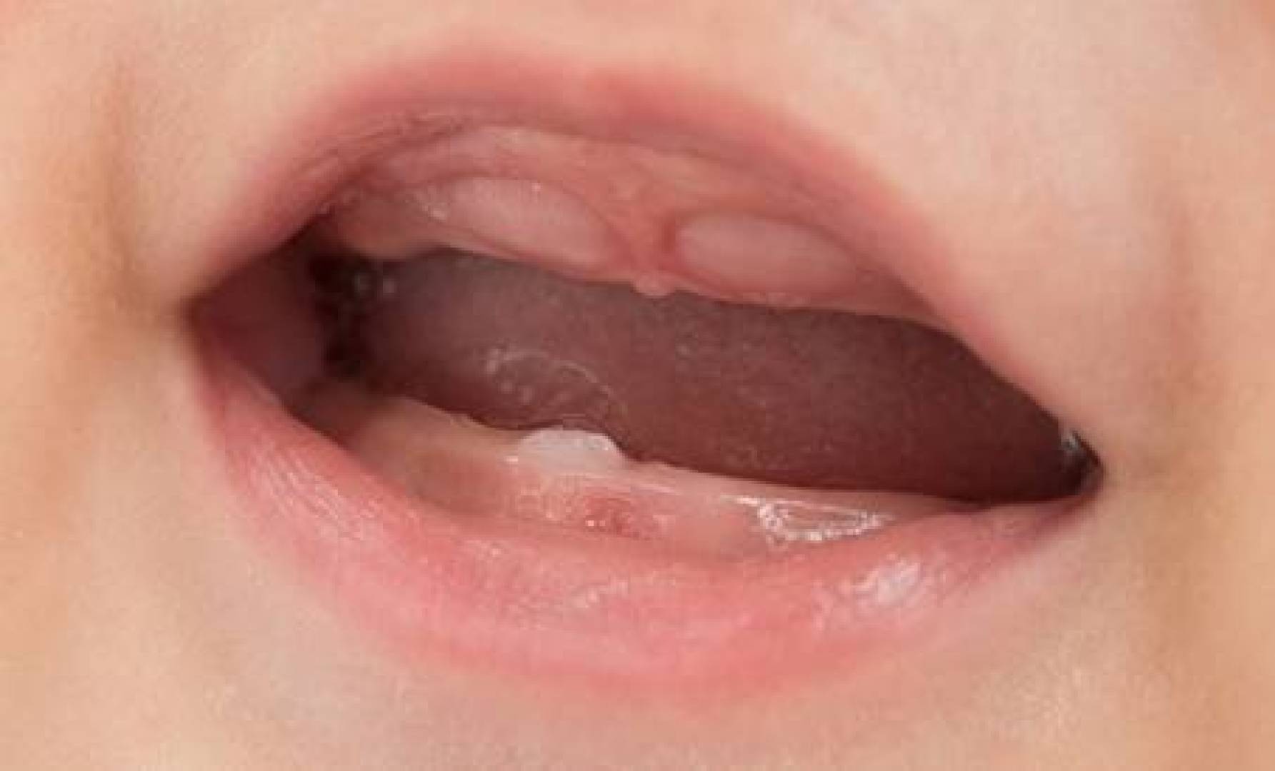 اكتشاف خلايا تعرف كيفية ومكان وزمان نمو الأسنان اكتشاف خلايا تعرف كيفية ومكان وزمان نمو الأسنان