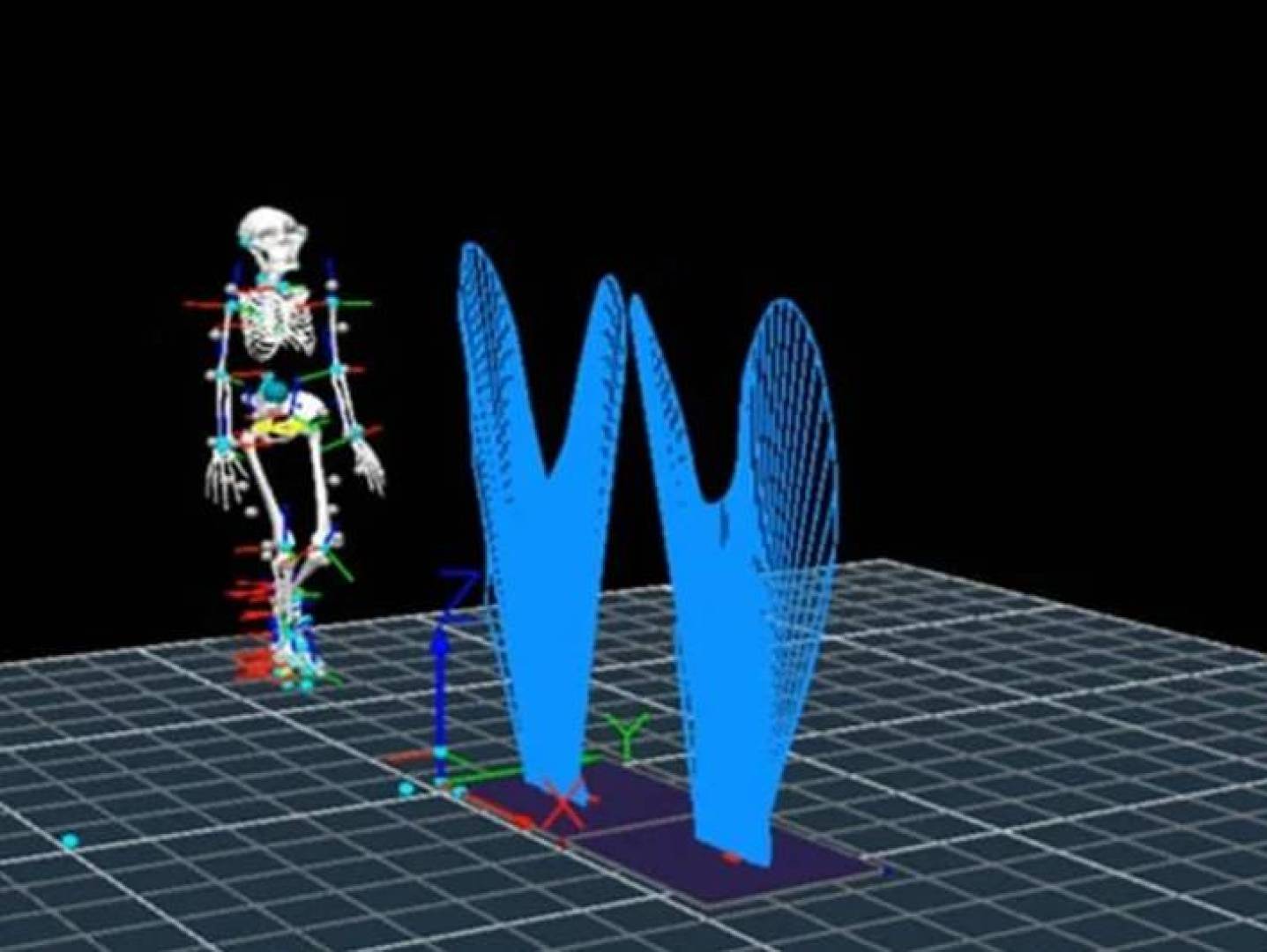 ابتكار أحذية ذكية لتحسين مشي الأطفال المصابين بالشلل الدماغي