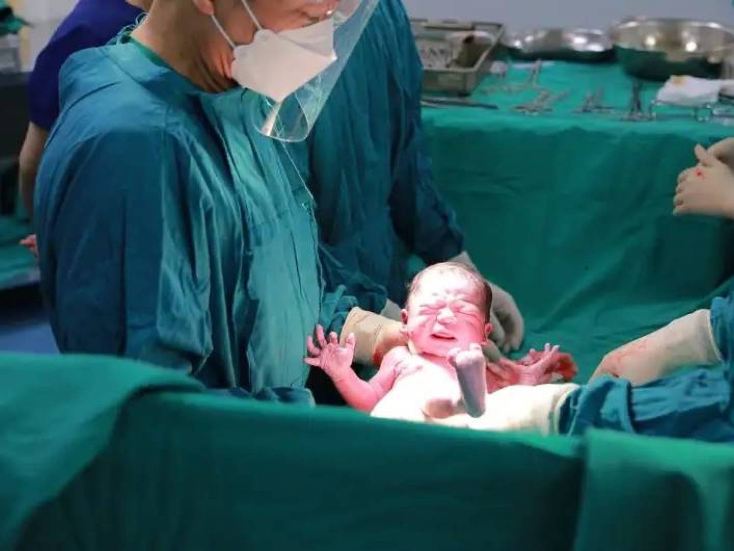 التخدير العام يمكن أن يكون خيار مناسب لتخفيف ألم الولادة القيصرية