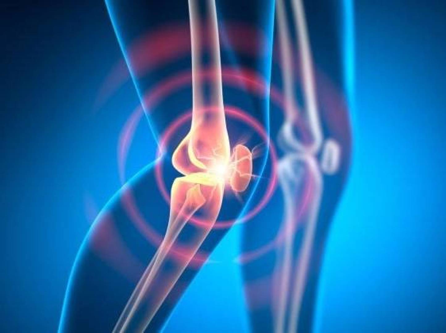 أفضل تمرين لتخفيف ألم التهاب مفصل الركبة