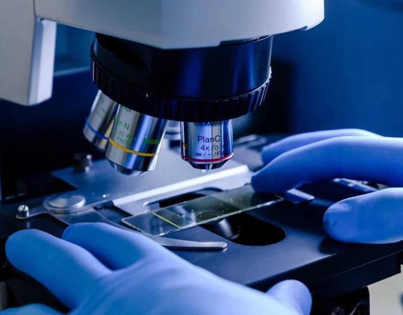 الذكاء الاصطناعي يساعد الجراحين على اكتشاف أورام الدماغ في غرفة العمليات