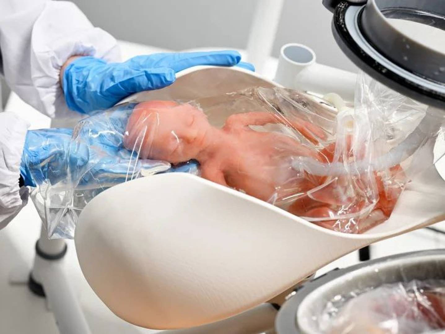 ابتكار هولندي قد ينقذ ملايين الأطفال الخدج حول العالم