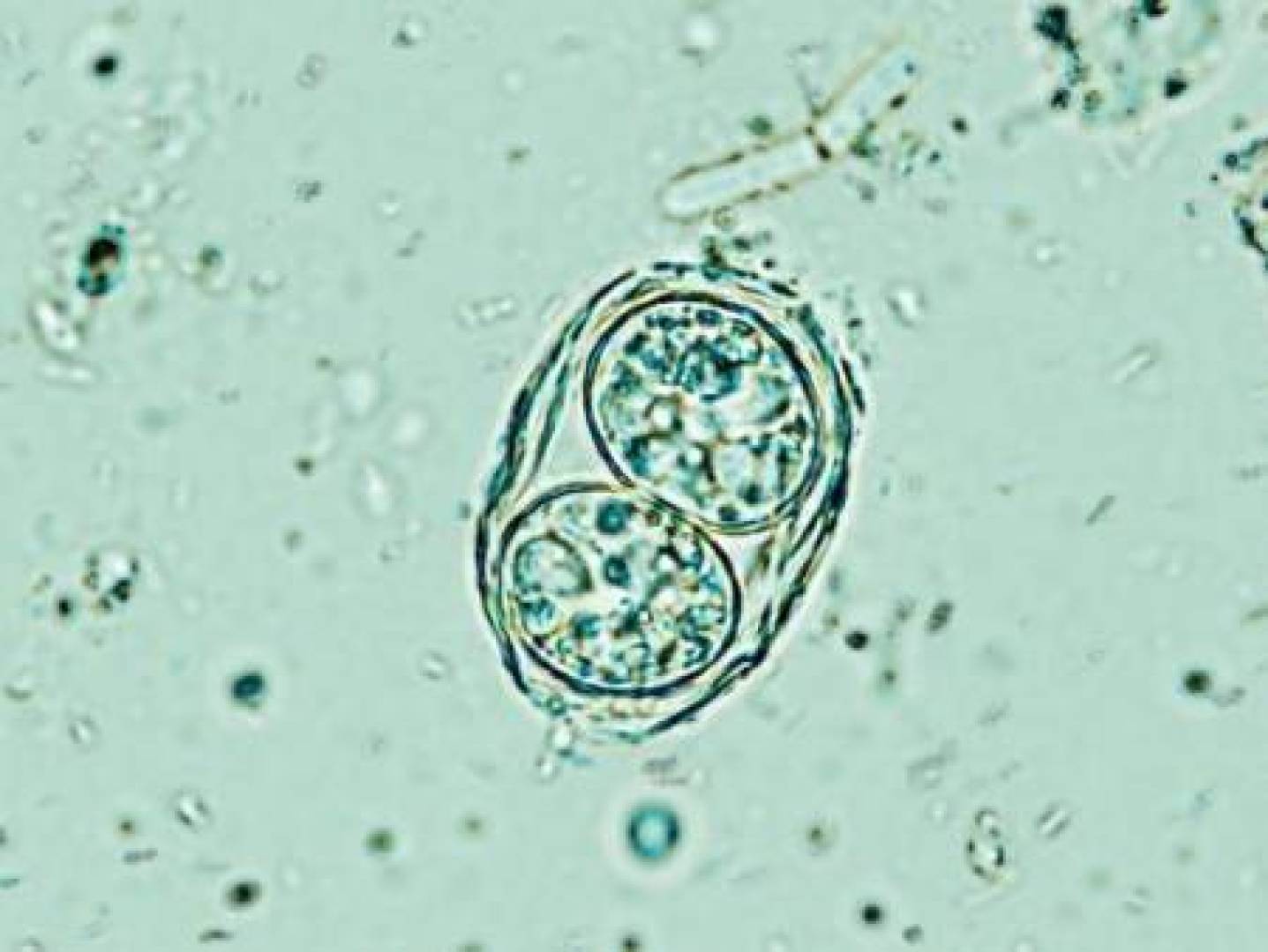 اكتشف  مفتاح بروتيني يمكنه القضاء على الطفيلي الدماغي اكتشف  مفتاح بروتيني يمكنه القضاء على الطفيلي الدماغي