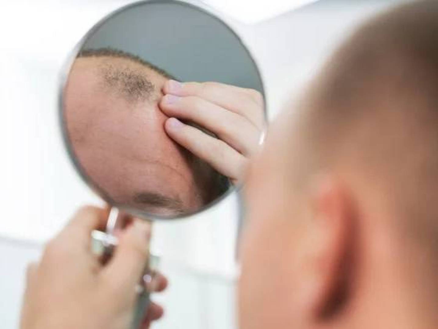 تايوان: صل موضعي يعالج تساقط الشعر ويعيد نموه خلال 20 يوما فقط