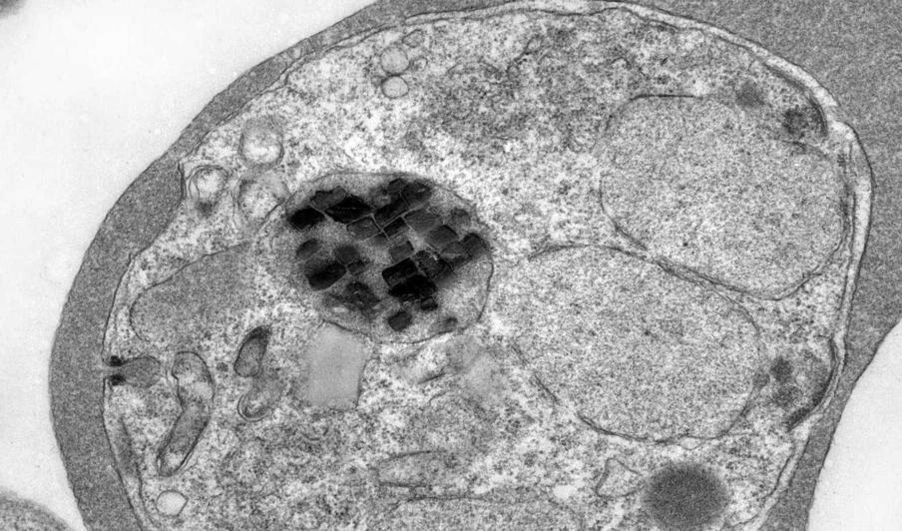 اكتشاف يتعلق بطفيلي الملاريا يفتح الأبواب لتطوير أدوية جديدة