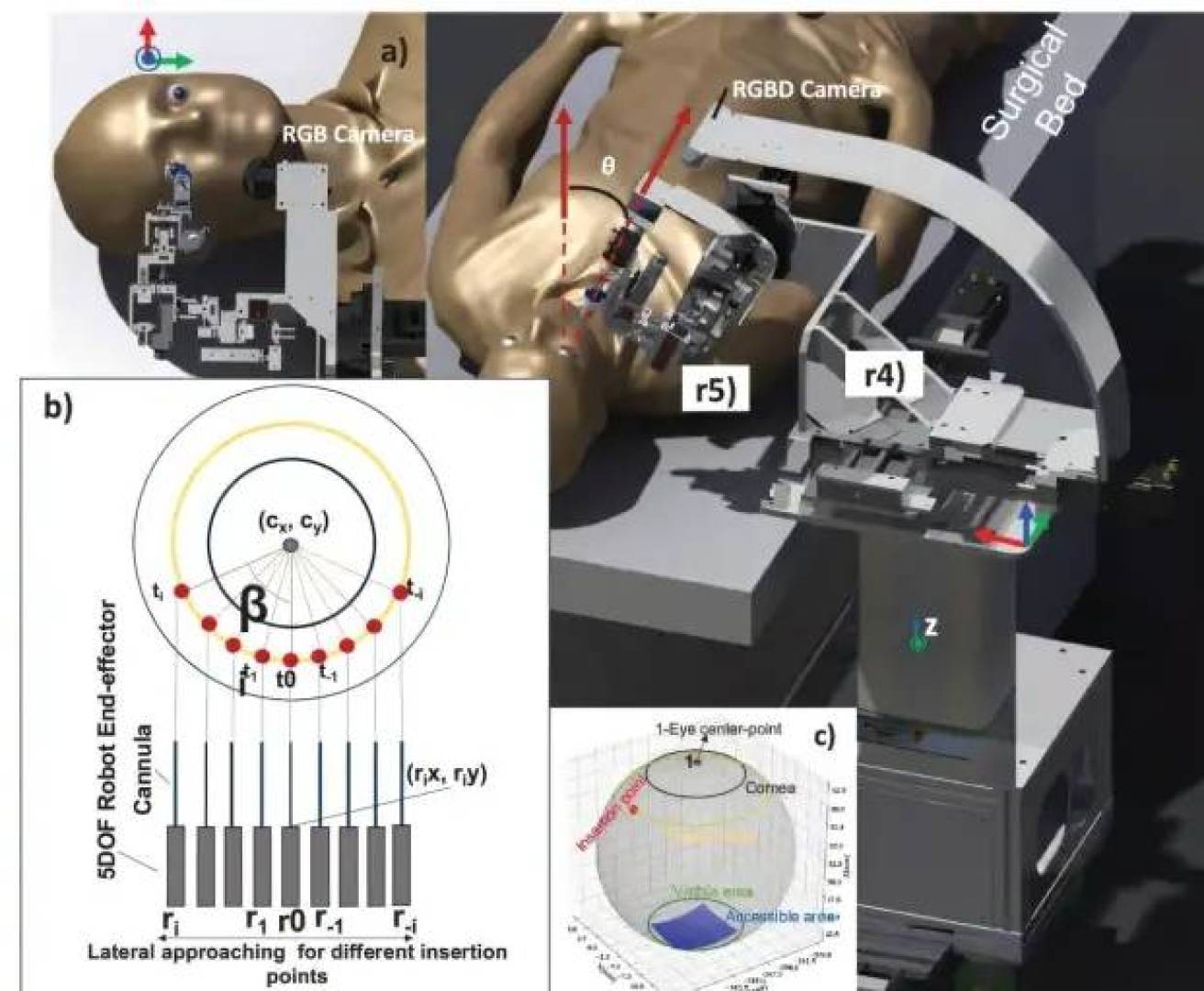 روبوت جديد لحقن دقيقة للضمور البقعي في العين في أقل من خمس دقائق
