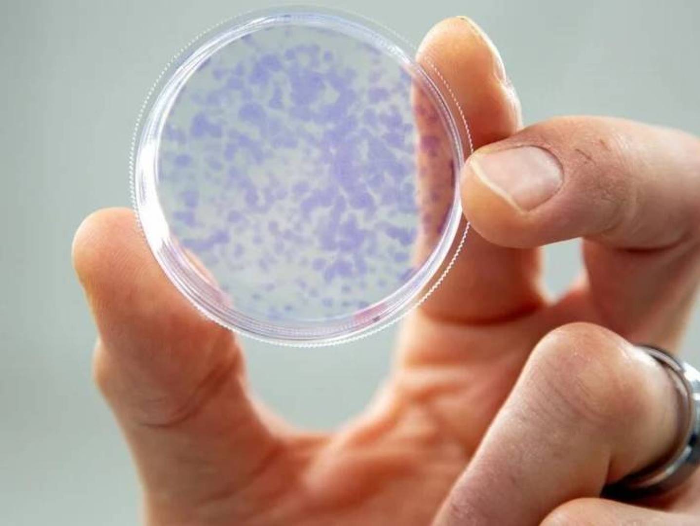 العلماء يكتشفون وسيلة لتشخيص خطر سرطان الرئة من أظافر القدم