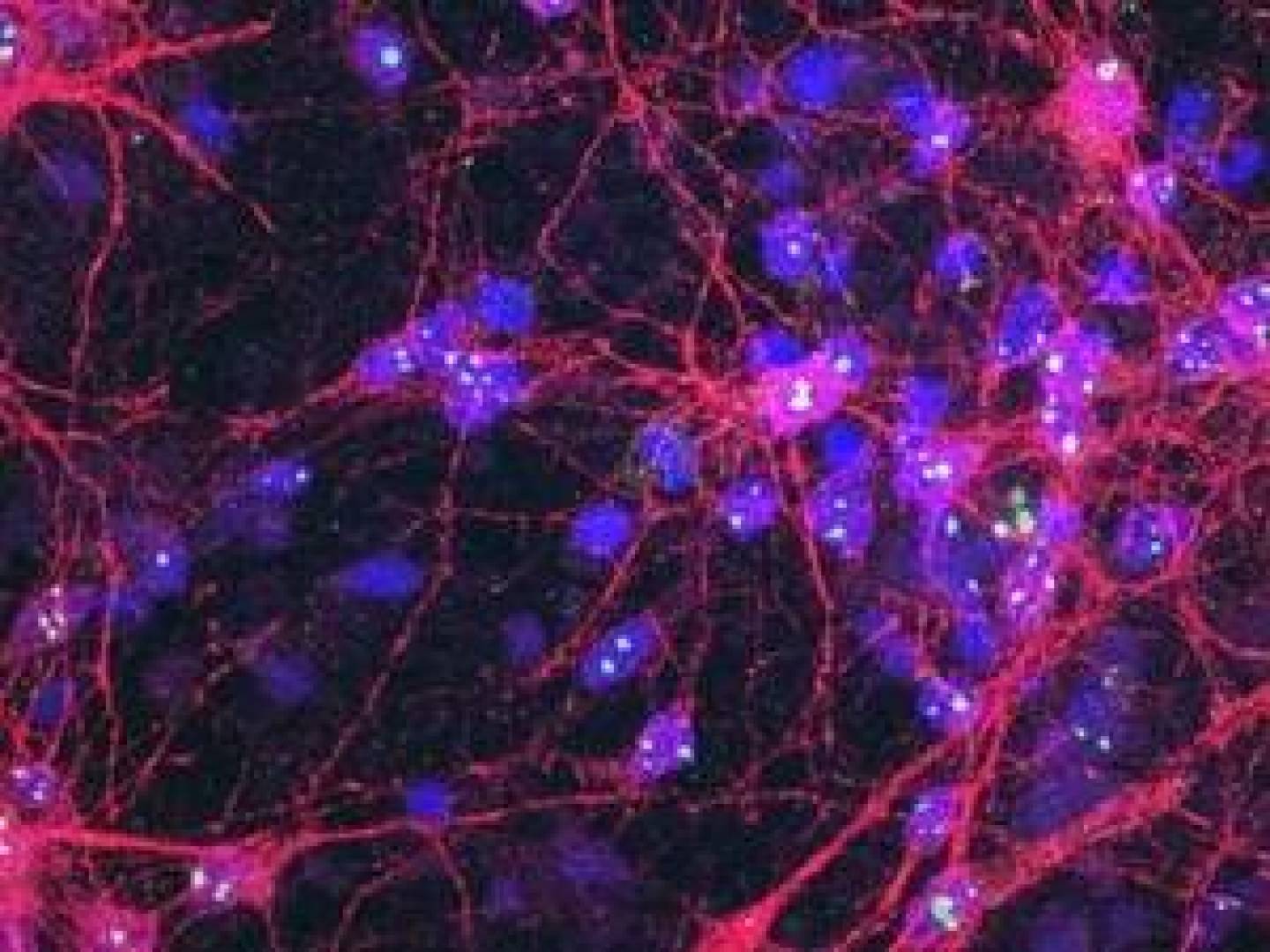 تأثير التوتر المزمن على تدفق الدم في الدماغ