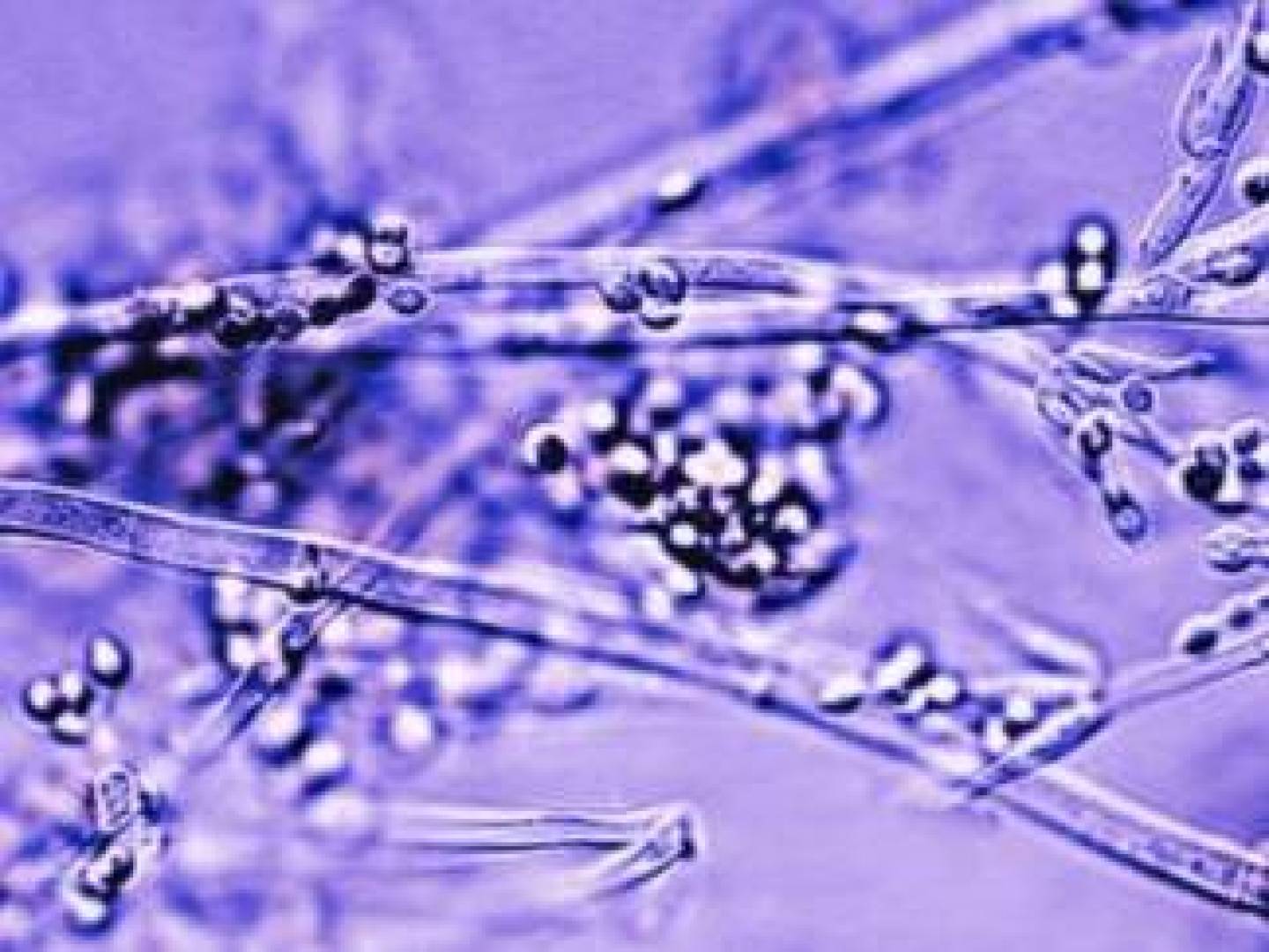 ضمادات فطرية حية قد تُحدث ثورة في علاج الجروح