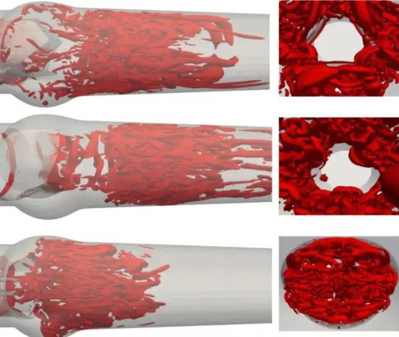 صمام القلب الميكانيكي الثلاثي الوريقات يغيّر مستقبل جراحات القلب