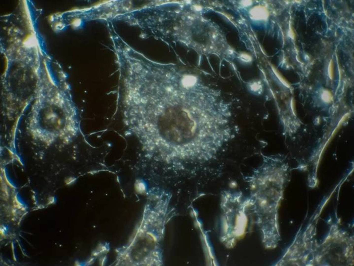 اختبار تنفس جديد يساعد في الكشف المبكر عن سرطان البنكرياس