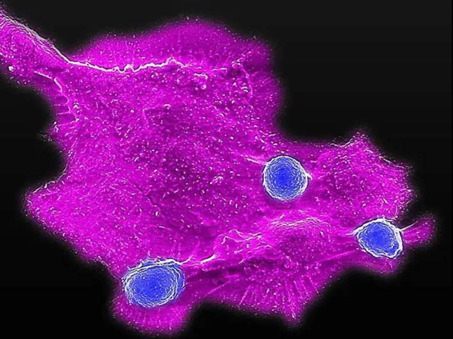 علاج مناعي قادر على القضاء على أنواع متعددة من السرطان علاج مناعي قادر على القضاء على أنواع متعددة من السرطان