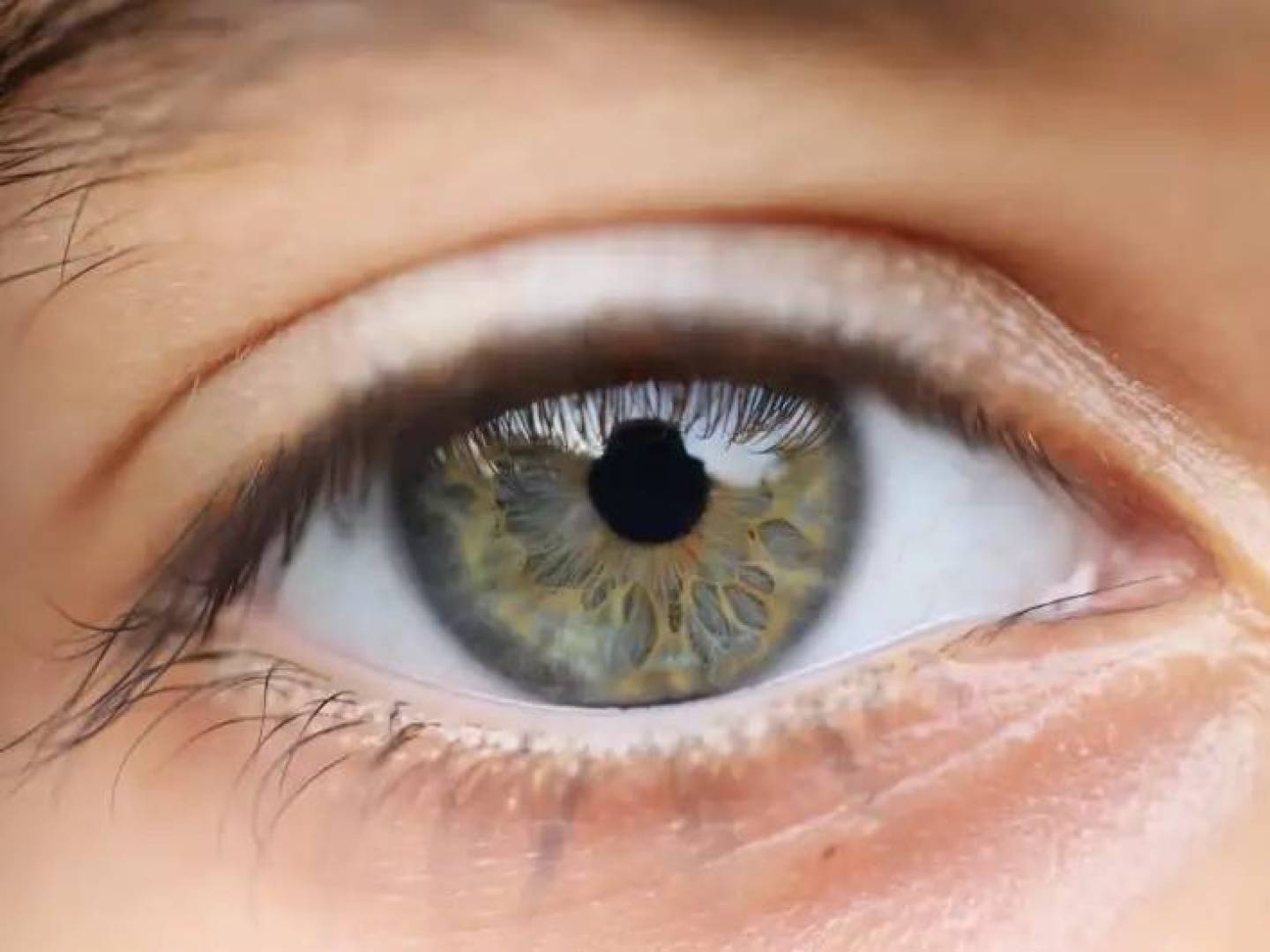 تأثير ارتفاع ضغط الدماغ إلى البصر