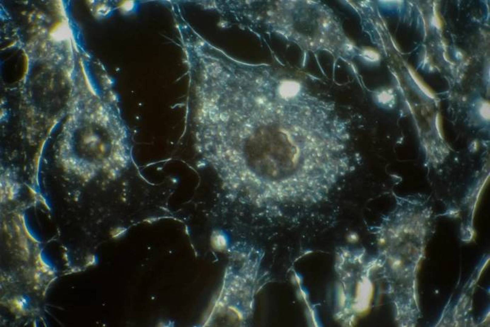 تطوير بروتينا مزدوج التأثير يهاجم الورم ويقطع عنه الدم في الوقت نفسه تطوير بروتينا مزدوج التأثير يهاجم الورم ويقطع عنه الدم في الوقت نفسه