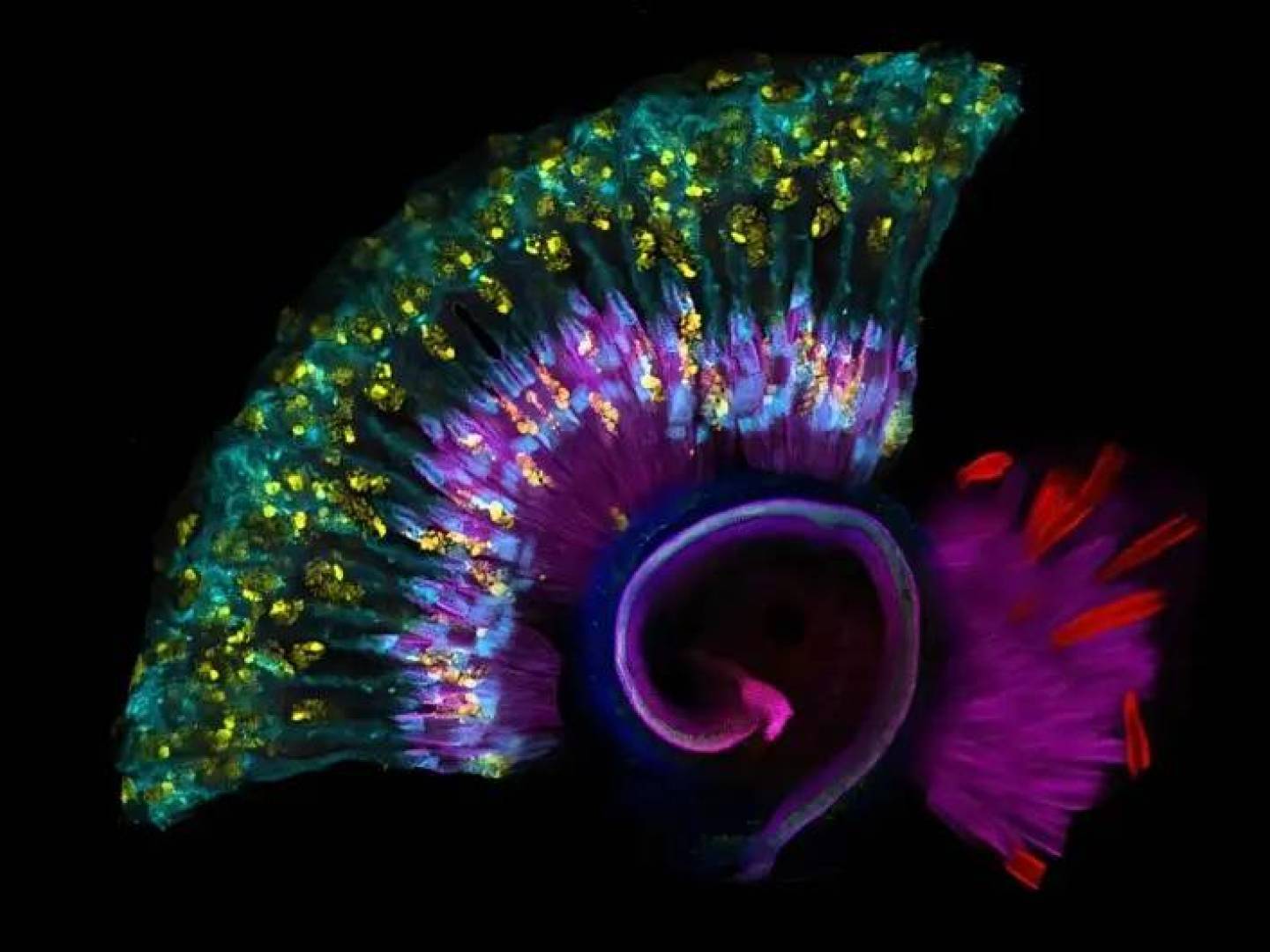 اكتشاف طفرة جينية جديدة تسبب الصمم