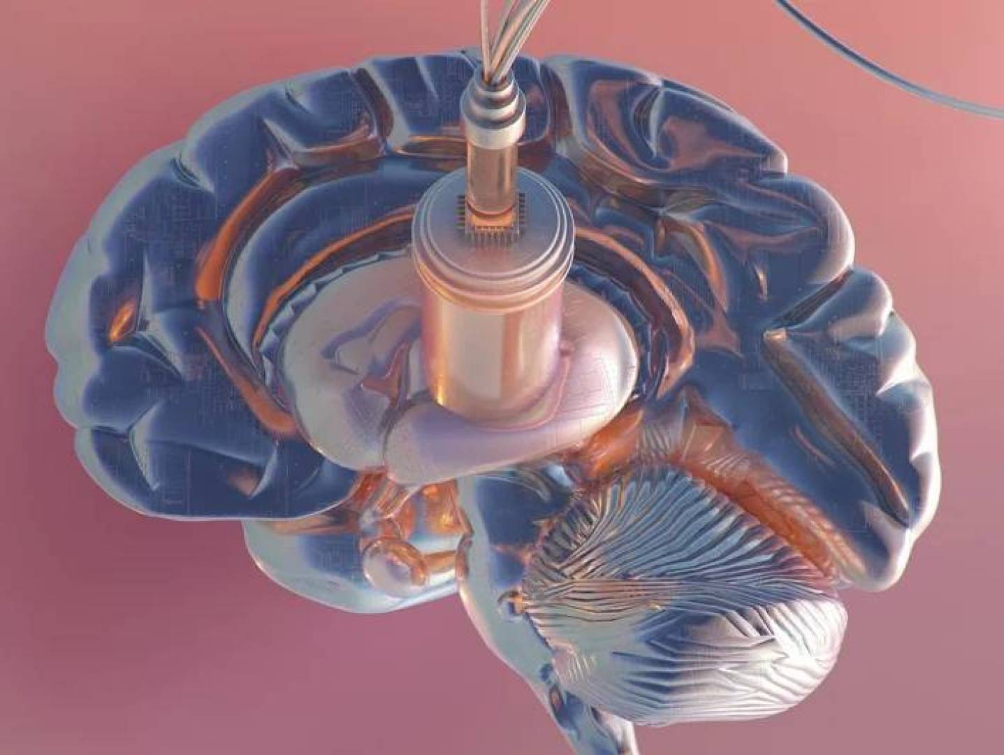 شركة Neuralink تدخل مرحلة الإنتاج الواسع للغرسات الدماغية