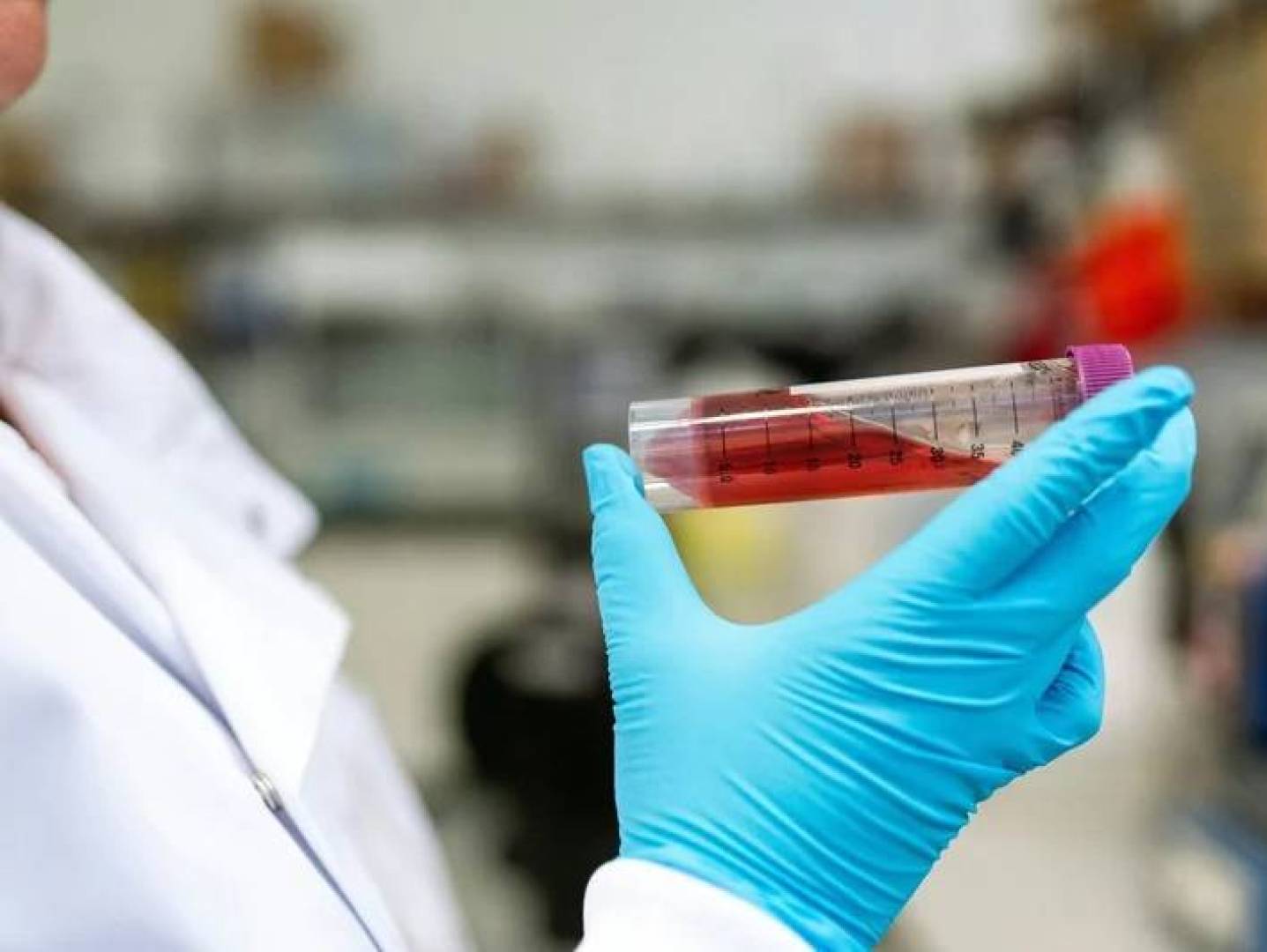 تقنية جديدة للكشف المبكر عن السرطان