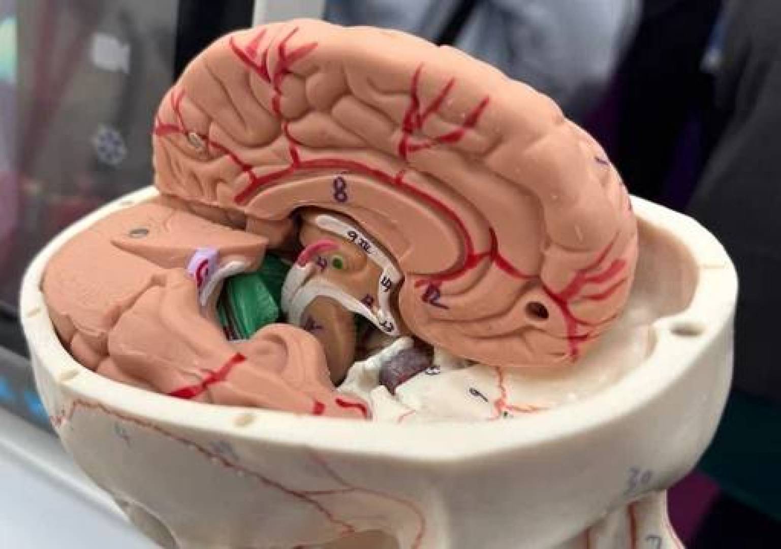 جهاز مبتكر يساعد الجراحين على تمييز الأورام عن الأنسجة الصحية بدقة
