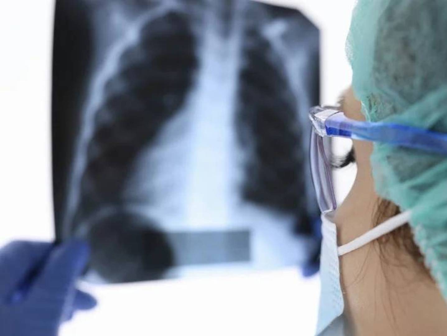 دواء جديد يحسن نسب الشفاء من السل ويقلص مدة علاجه