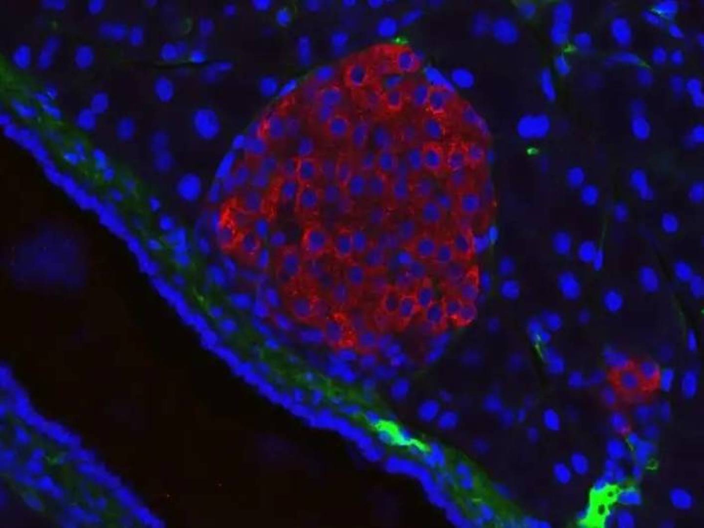 تقنية تصوير لمراقبة خلايا البنكرياس تكشف أسرار إفراز الأنسولين