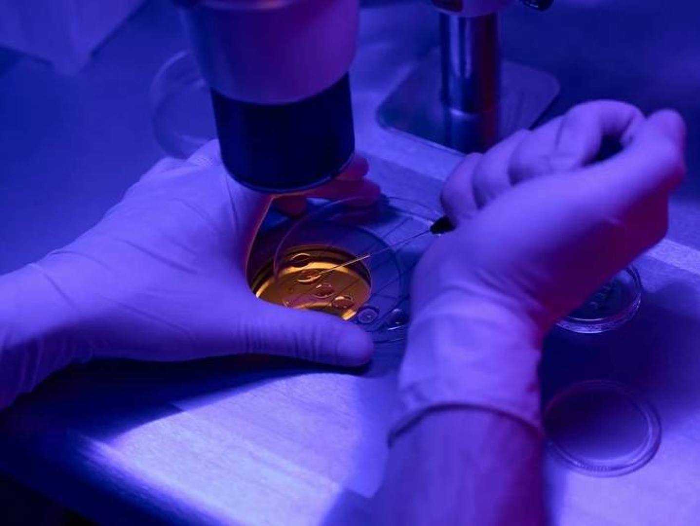 نموذج ذكاء اصطناعي يكشف الأمراض الوراثية النادرة بدقة عالية