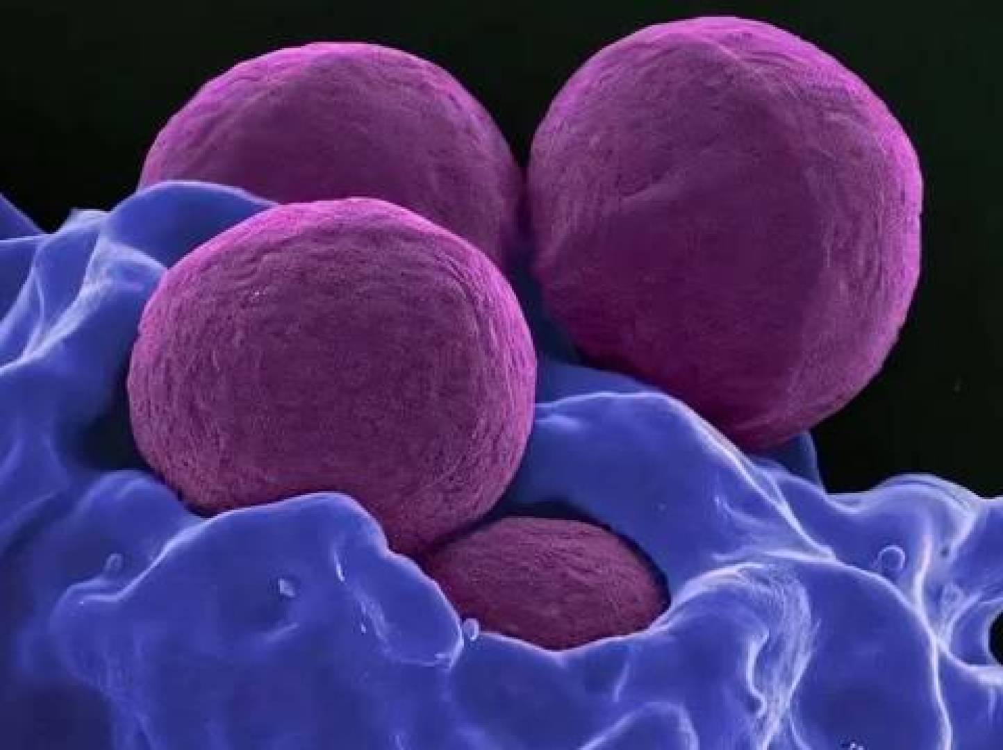 ابتكار دواء ثنائي الفعالية ضد الالتهابات والبكتيريا