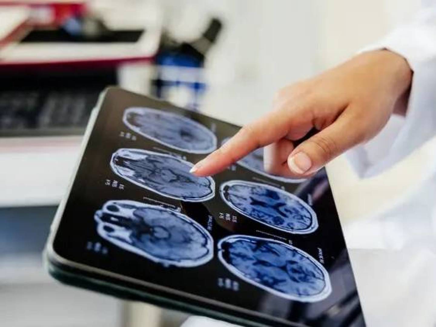 الكشف عن كيفية تخزين الدماغ للذكريات طويلة الأمد