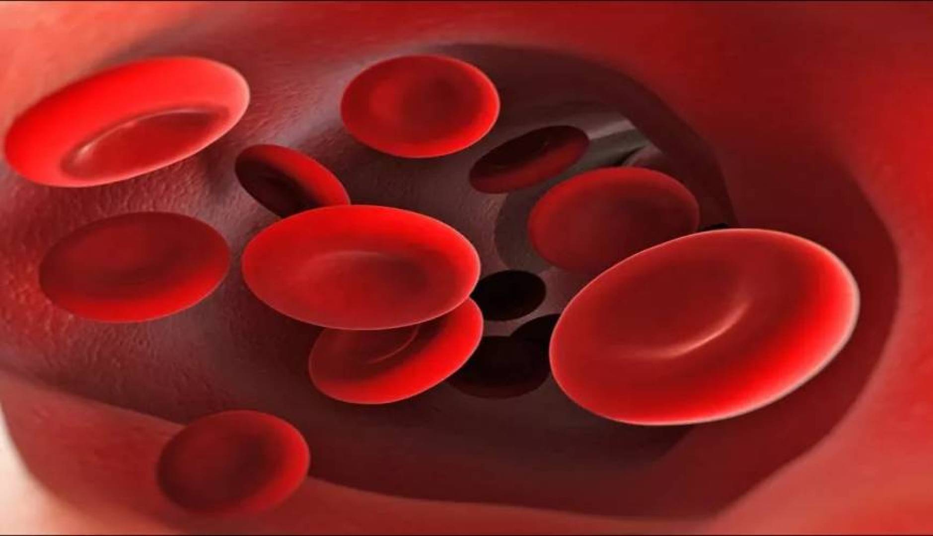 الكشف عن التأثيرات طويلة المدى لنقص الحديد الغذائي