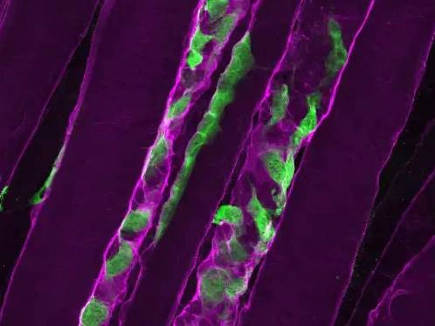 دراسة جديدة تكشف سبب توقف تجدد العضلات لدى مرضى ضمور العضلات النادر
