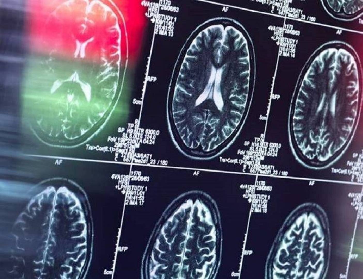 تأثير العوامل اليومية على تكوين العادات في الدماغ