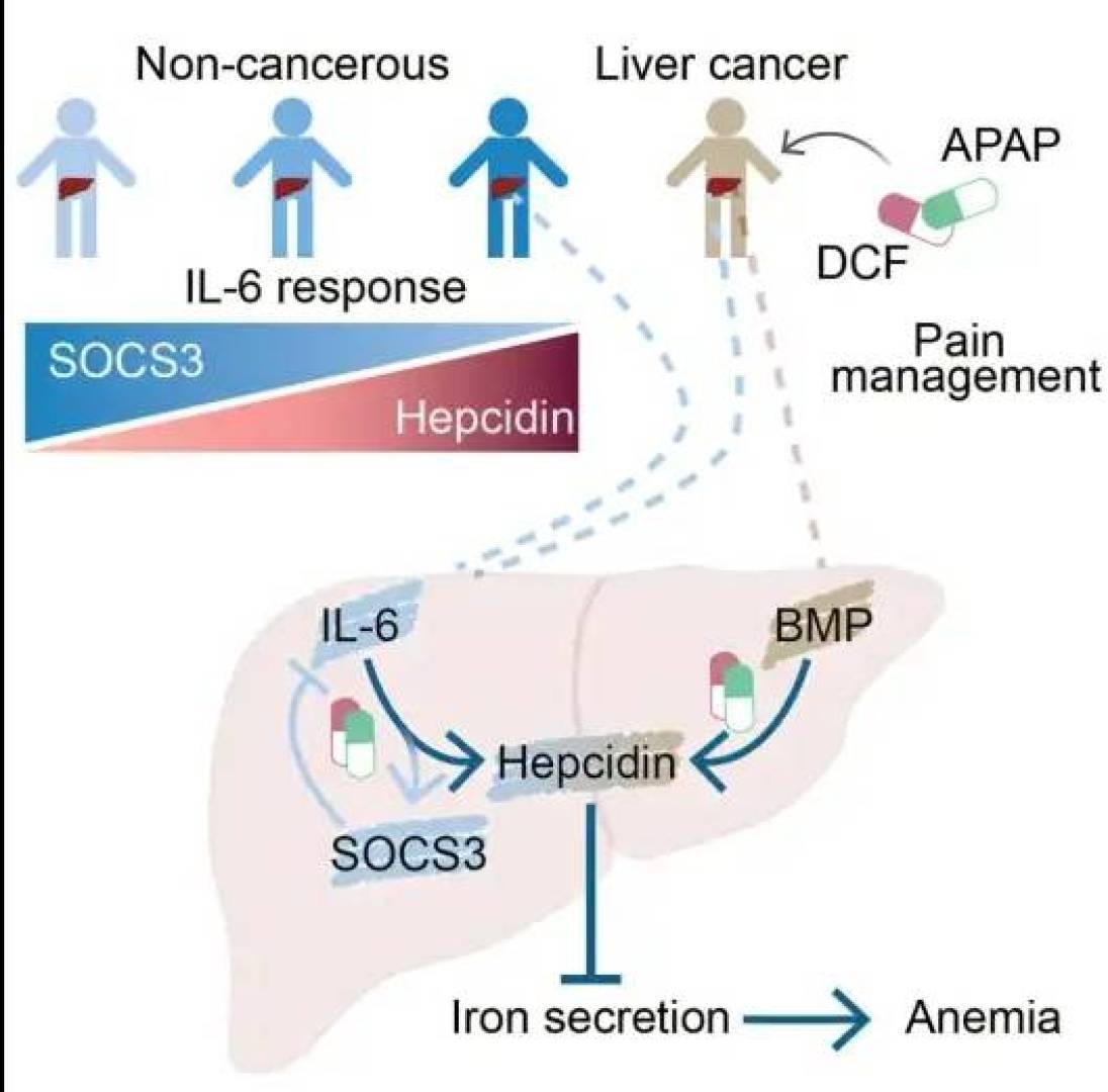 مسكنات الألم تسبب فقر الدم لدى مرضى السرطان