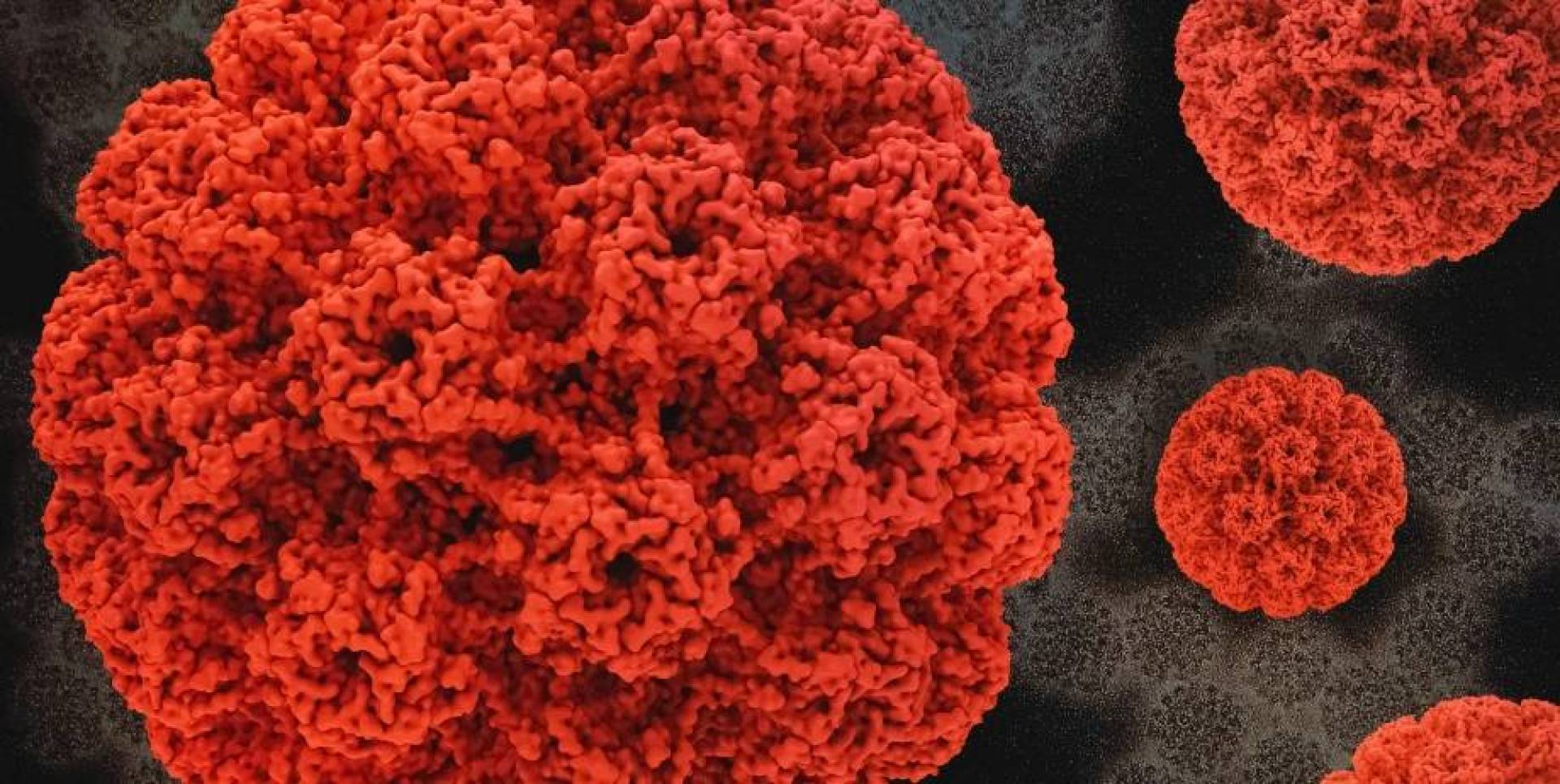 فيروس إبشتاين–بار يثبت ارتباطه المباشر بمرض الذئبة