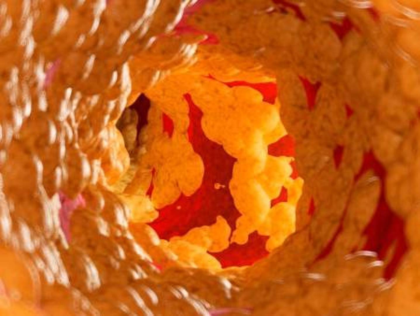 دواء جديد يخفض الكوليسترول الضار بنسبة 58%