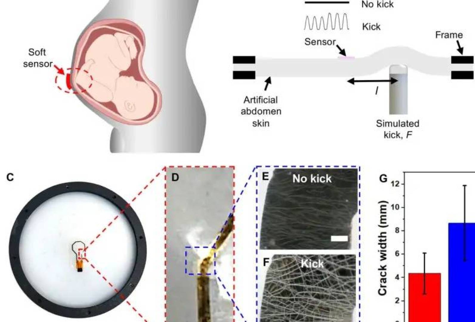 لاصقة ذكية تراقب حركات الجنين داخل الرحم