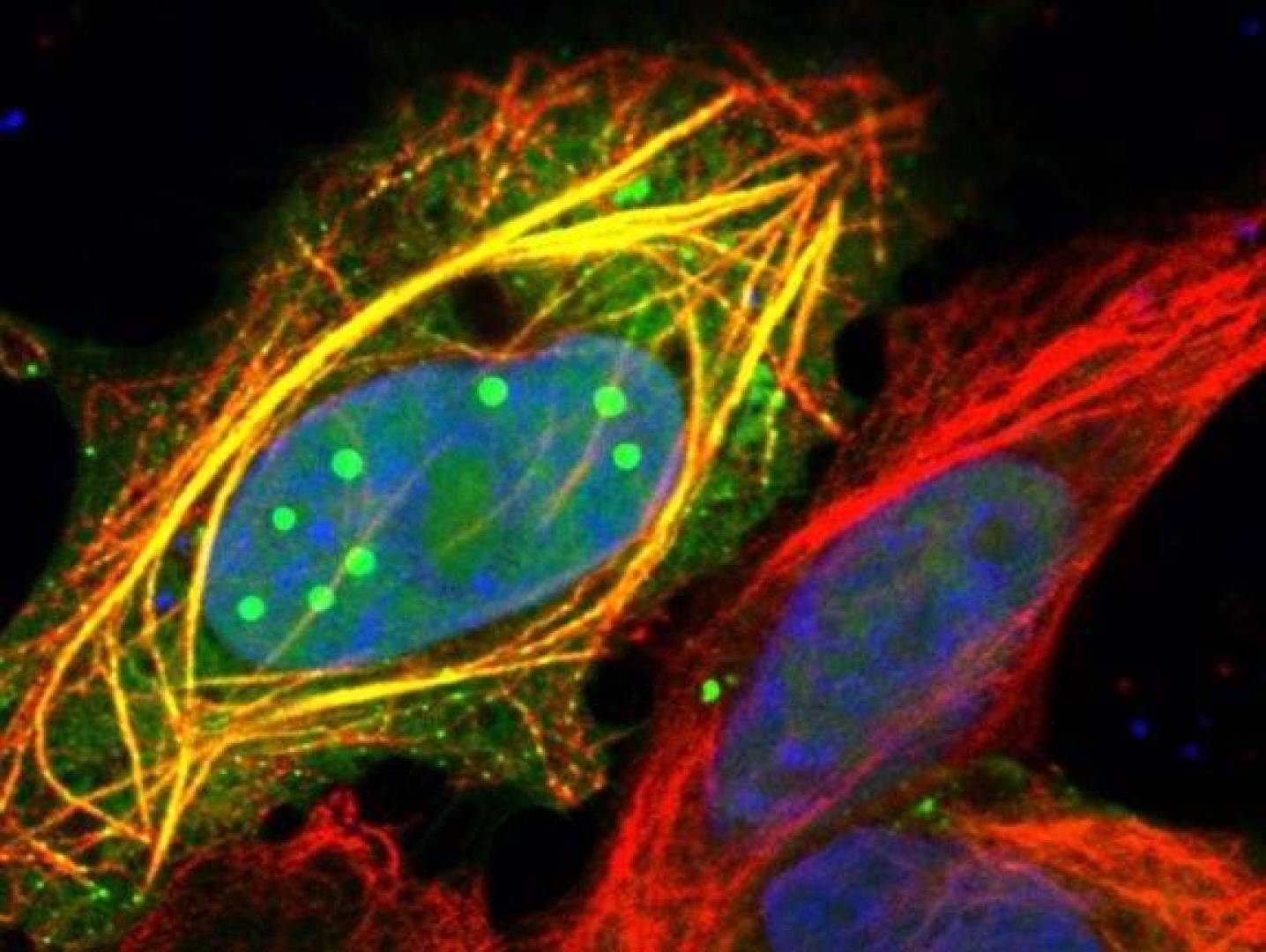 داء الكلب يكشف أسراره.. بروتين متحوّل يسيطر على الخلايا البشرية