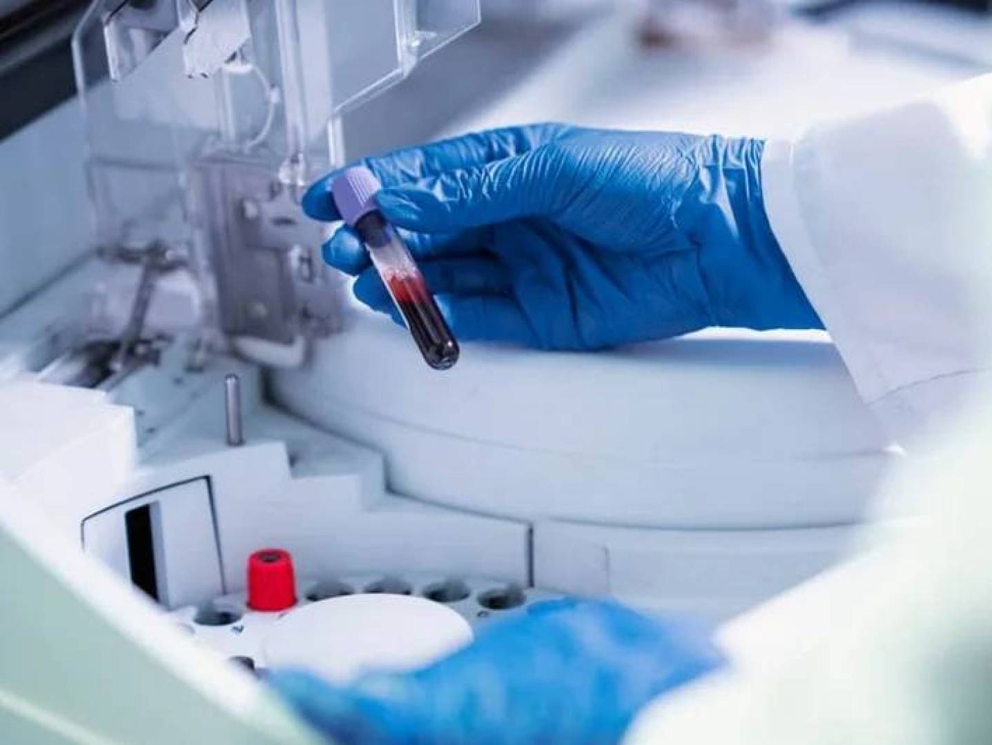 ذكاء اصطناعي جديد قادر على تحليل خلايا الدم بدقة متناهية