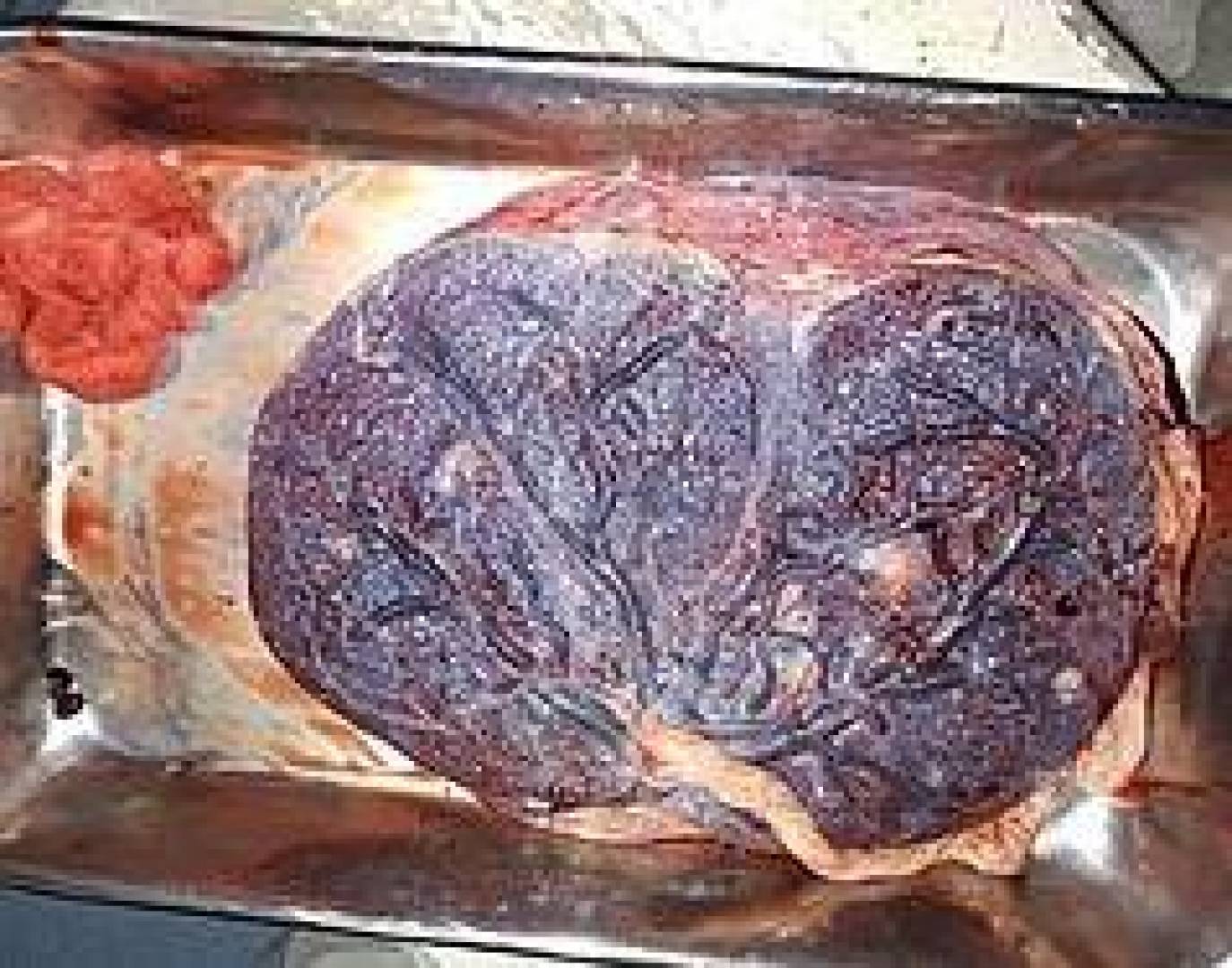 اكتشاف المراحل الأولى لتكوين المشيمة البشرية