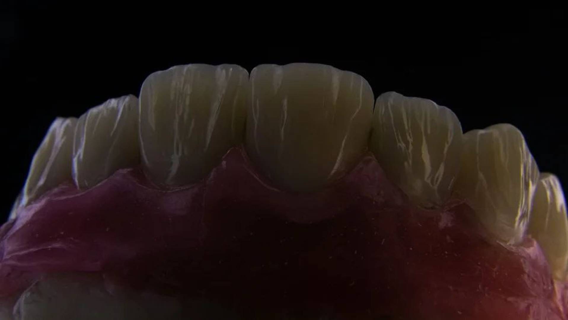 تقنية حديثة لتحفيز تجدد أنسجة اللثة وتقلل مضاعفات زراعة الأسنان