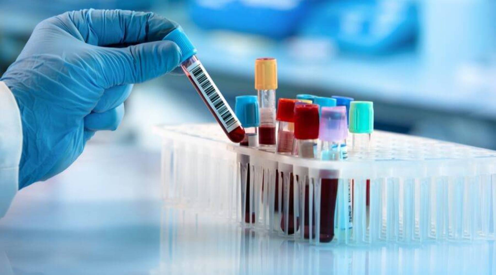 اكتشاف سريع لمؤشر المناعة 