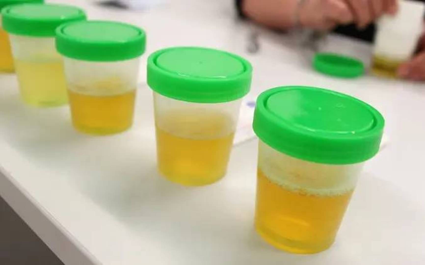 ابتكار علمي يستخدم البول لتوليد الطاقة ومعالجة المياه في آن واحد