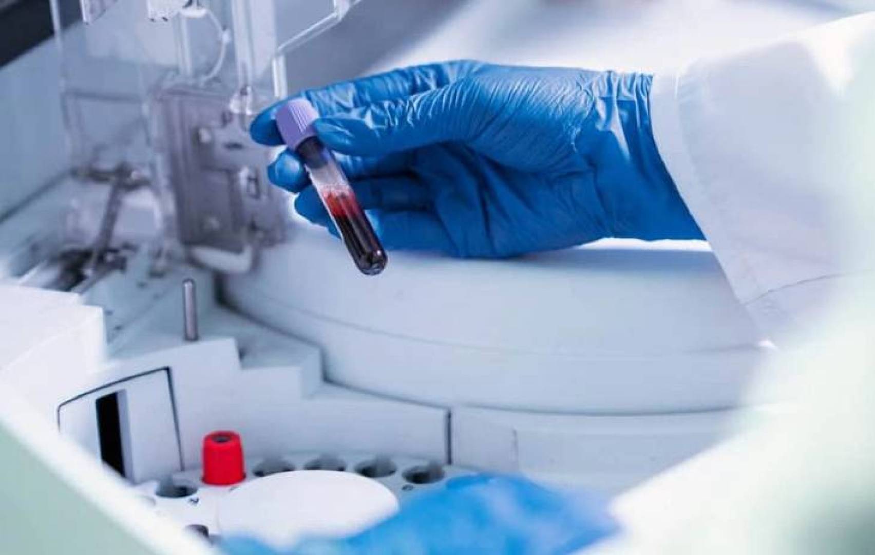 دراسة علمية تكشف دور بروتين الألبومين في الوقاية من الفطر الأسود القاتل