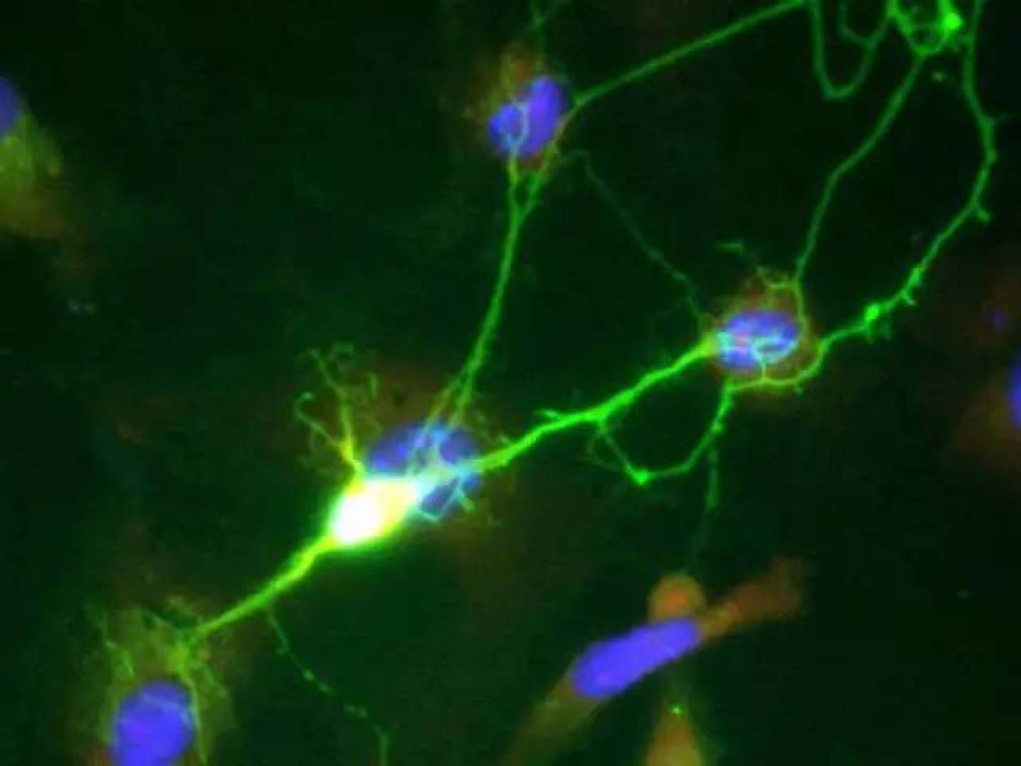 اختراق علمي لفهم الخلايا العصبية المسؤولة عن الألم المزمن