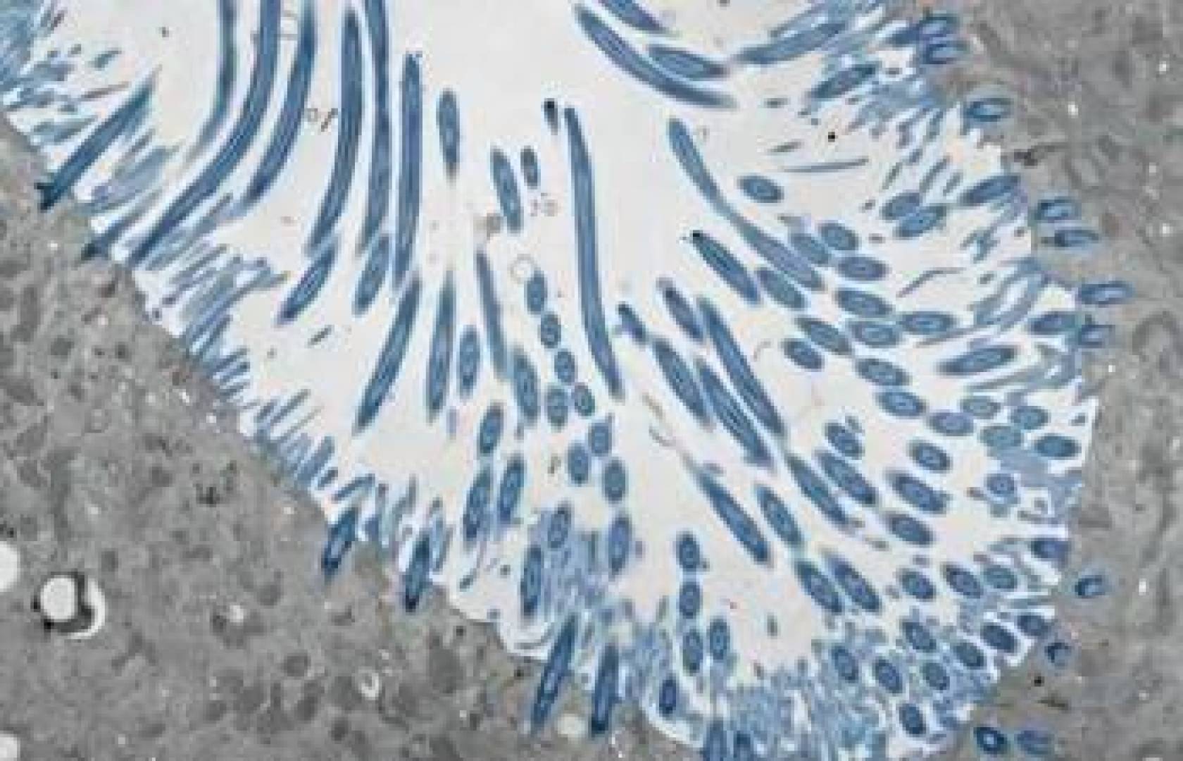 شدة الزكام لا يحددها الفيروس بل قوة دفاع الأنف