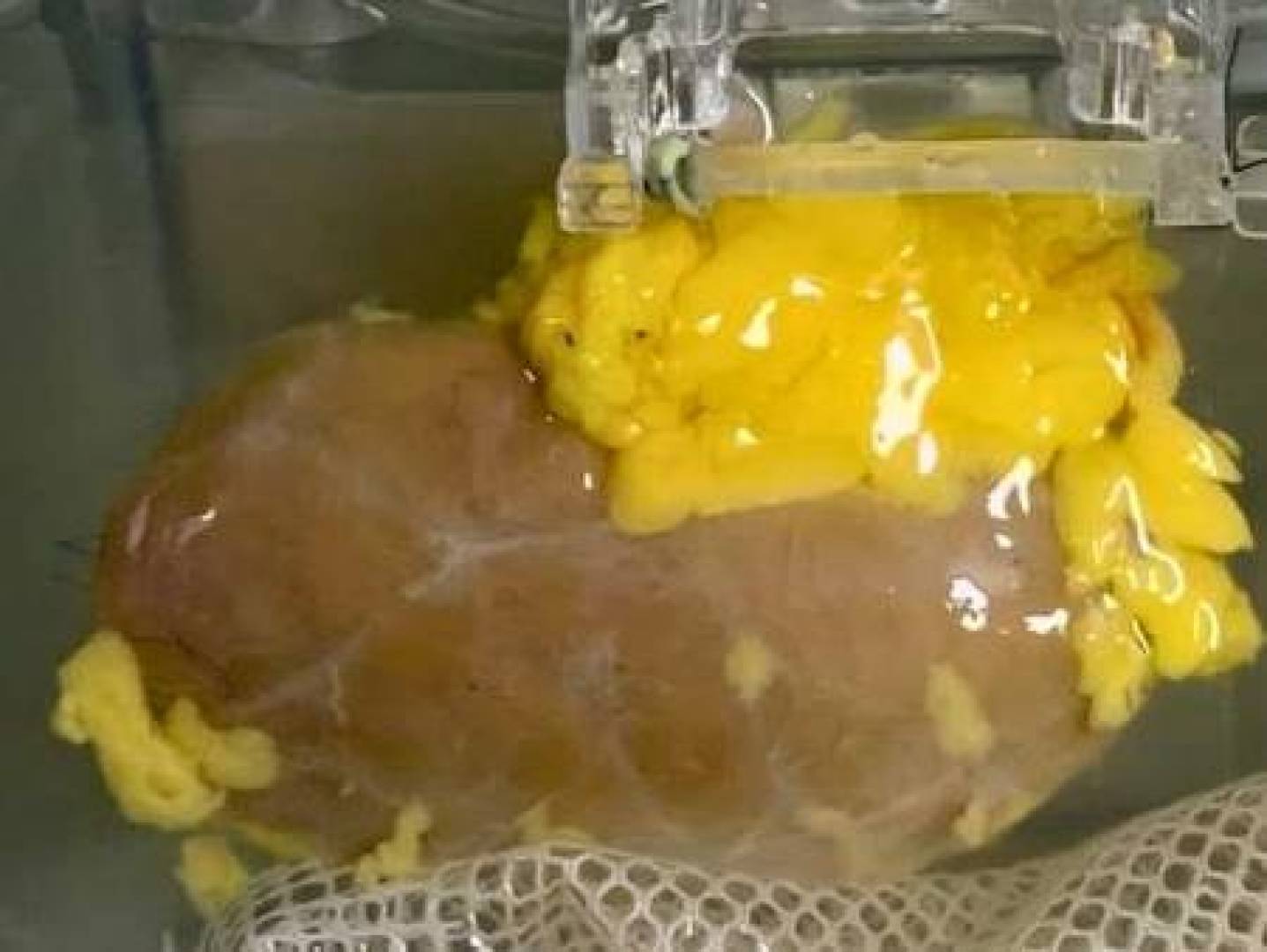 ابتكار علمي هام يغير مستقبل زراعة الكلى