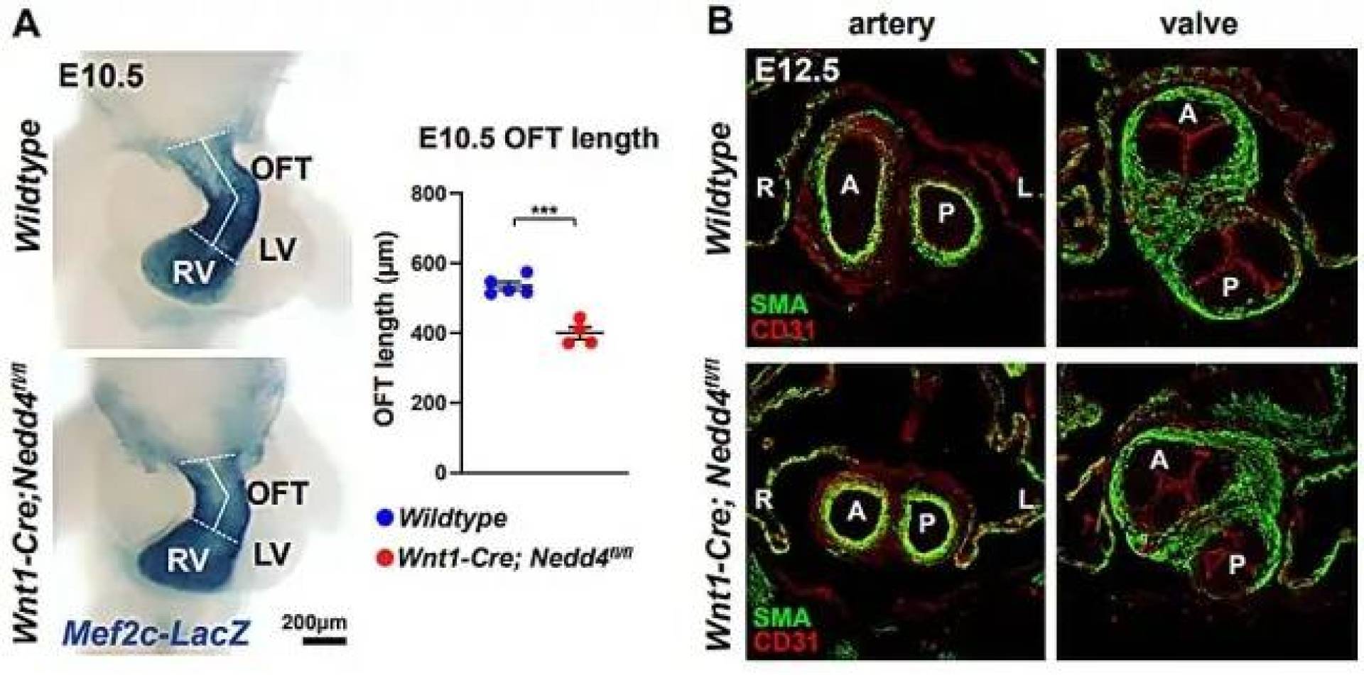 اكتشاف علمي جديد يوضح كيف تتحكم إشارة خلوية دقيقة في تكوّن قلب الإنسان