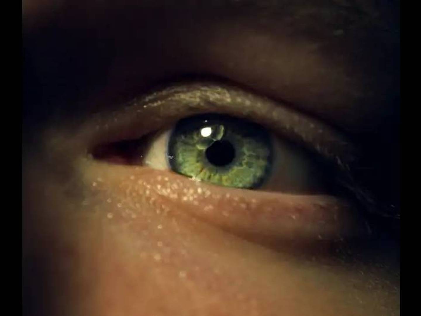 دراسة بريطانية: علاج نشط قد يطيل حياة مرضى سرطان العين النادر