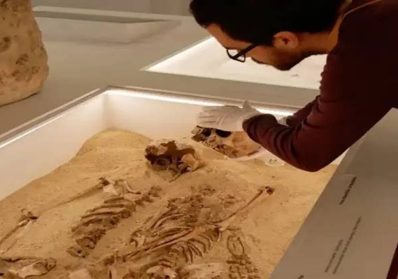 نجح علماء في تأكيد أقدم تشخيص وراثي في تاريخ البشر نادر عمره 12 ألف عام