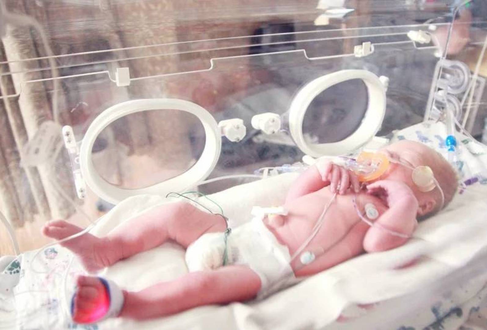 ابتكار ذكي يراقب تنفس حديثي الولادة ويكشف أمراض الجهاز التنفسي مبكرا