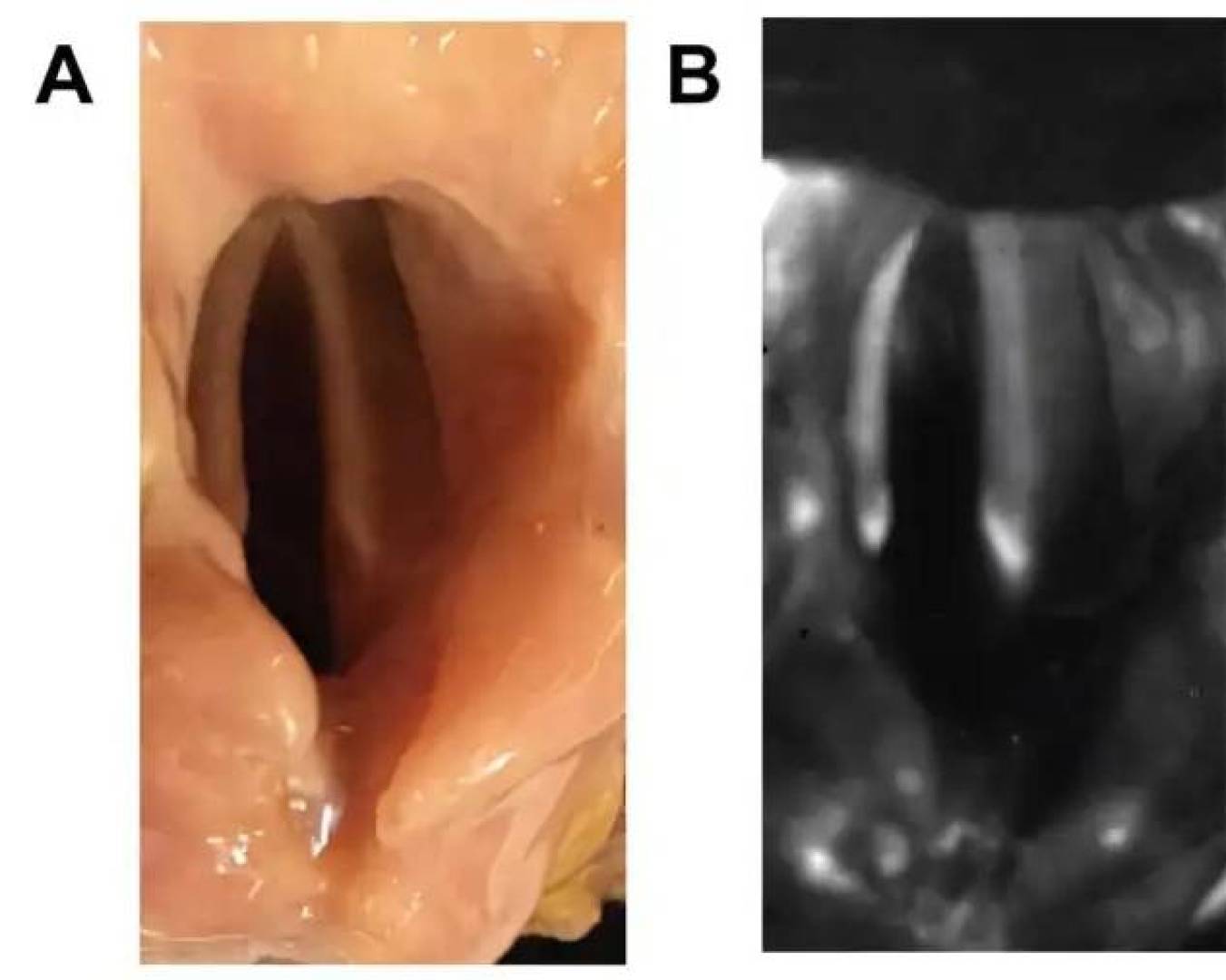 تقنية تصوير جديدة تحدث ثورة في دقة علاج شلل الحبال الصوتية